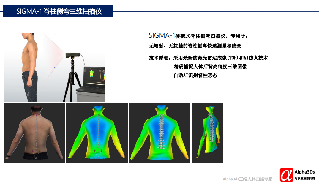 SIGMA-1 便携式脊柱侧弯三维扫描仪